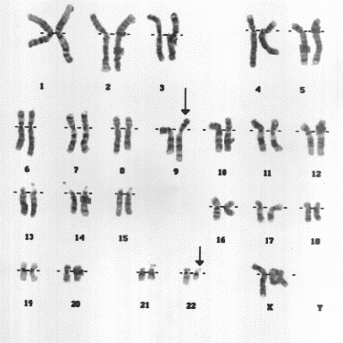 karyotype.gif