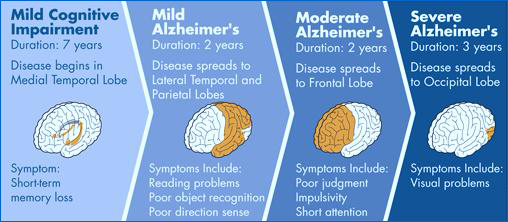 stages-of-alzheimers.jpg