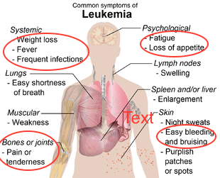 symptoms_of_leukemia.png